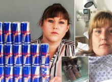 Addicted to Red Bull, She Has Been Drinking 20 Cans a Day for 4 Years! Look at What She Looks Like Today