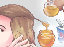 Get Rid of Dandruff Fast Thanks to Those 5 Natural Remedies