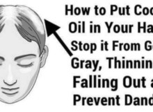 home-remedies-for-premature-graying-of-hair