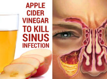 You have a sinus infection Treat it instantly, you have this in your kitchen!