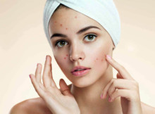 Magical Natural Homemade Acne Mask