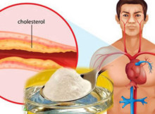 Say Bye Bye To Cholesterol and High Blood Pressure After Using This Home Remedy