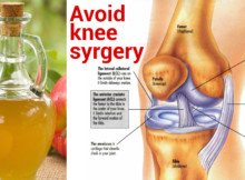 WITH THESE 2 INGREDIENTS, HE AVOIDED KNEE SURGERY, WENT HOME WITHOUT ANY PAIN AND DECIDED TO REVEAL HIS INCREDIBLE REMEDY WITH YOU!