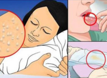 10 Cautioning Indications that You Might Be Infected with HIV