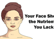 5 Signs of Nutrient Deficiencies That Are Written All Over Your Face