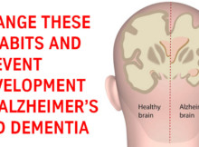 Change these 9 habits and prevent development of Alzheimer’s and Dementia