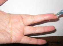 Find Out This Particular Spot on the Finger That Will Lower Blood Pressure and Reduce Every Pain Right Away!