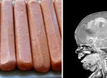 Stop giving your children hotdogs right away! – Doctors advice