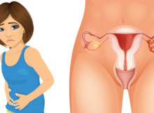 These are the 4 symptoms that you need to be able to recognize in regards to ovarian cancer