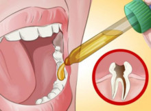 This magical homemade remedy will help you get rid of toothache.