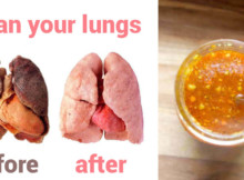 Use this elixir to detoxify your body and clean your lungs!