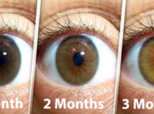 Use this natural remedy to improve your vision and prevent cataract – it is 100% natural