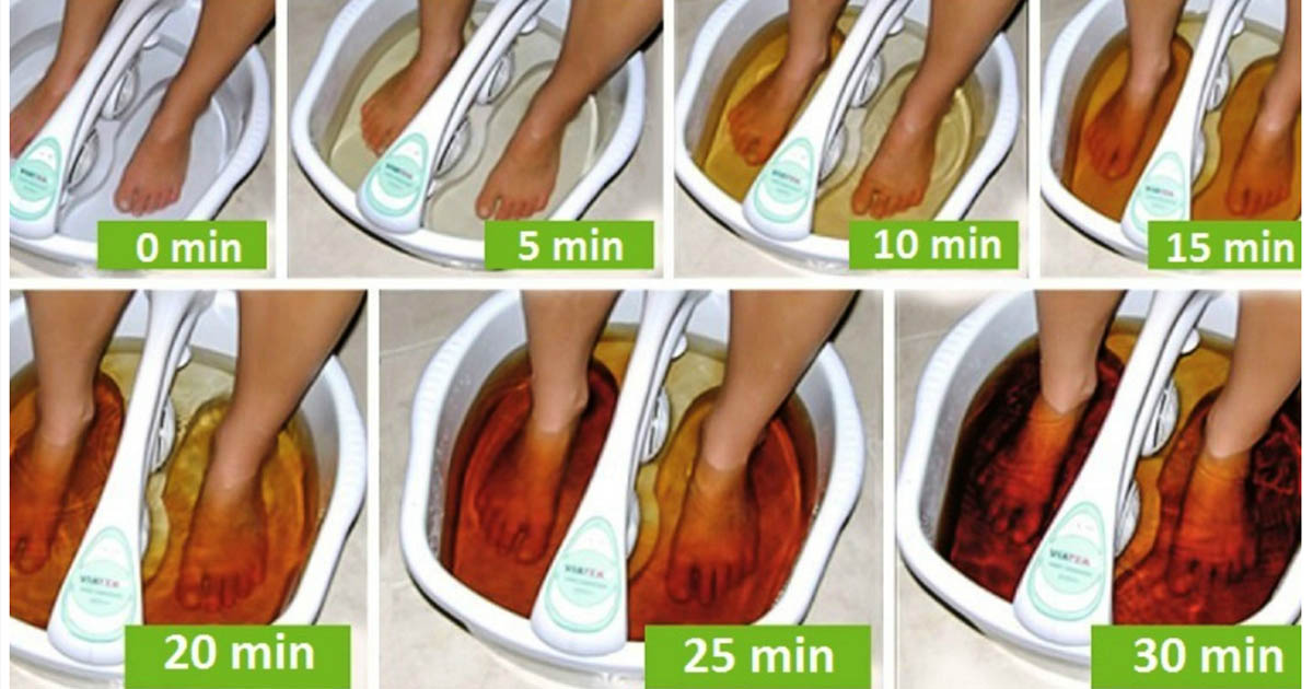 Yes, You Could Detox Through Your Feet Healthy Natural Solution
