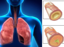 How to Get Rid of Phlegm and Mucus in Chest & Throat (Instant Result)