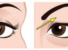 How to Treat Droopy Eyelids Naturally. The Results Are Amazing!