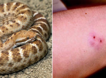 Quick Tip Emergency Alternative Medicine for Snake Bites