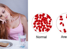 Start eating more iron right away if you experience any of these 10 signs of anemia