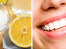 Watch Your Teeth Get White in Just 2 Min with This Home Remedy