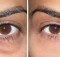 How to Get Rid of Stubborn Eye Bags with Essential Oil and Aloe Vera