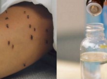 Mosquitoes Won’t Leave You Alone The 1 Thing Doctors Say Works Better Than Toxic Repellents