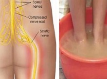 Say Goodbye To Sciatic Nerve Pain In Just 10 Minutes With This Natural Method!