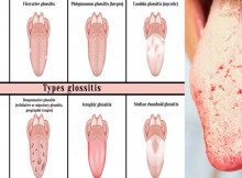 7 Warning Signs Your Tongue May Be Sending